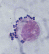 monocyte with S.aureus on surface