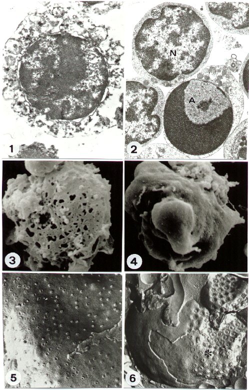 Apoptosis - Wikipedia, the free.