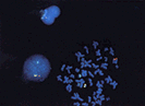 Epi-fluorescence
