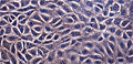 Phase Contrast